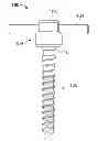 Fig. 01 - Low profile dual locking fixation system and offset anchor member