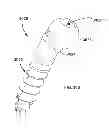 Fig. 35 - Low profile dual locking fixation system and offset anchor member