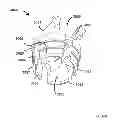 Fig. 38 - Low profile dual locking fixation system and offset anchor member