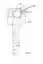 Fig. 44 - Low profile dual locking fixation system and offset anchor member