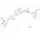 Fig. 63 - Low profile dual locking fixation system and offset anchor member