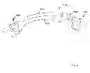 Fig. 64 - Low profile dual locking fixation system and offset anchor member