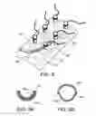 Fig. 09 - Methods and devices for improving percutaneous access in minimally invasive surgeries