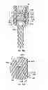 Fig. 06 - PEDICLE SCREW ASSEMBLY