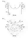 Fig. 07 - PEDICLE SCREW ASSEMBLY