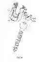Fig. 10 - PEDICLE SCREW ASSEMBLY