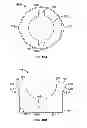 Fig. 11 - PEDICLE SCREW ASSEMBLY