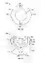 Fig. 12 - PEDICLE SCREW ASSEMBLY