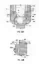Fig. 14 - PEDICLE SCREW ASSEMBLY