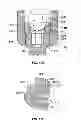 Fig. 15 - PEDICLE SCREW ASSEMBLY