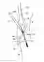 Fig. 01 - Method of using a minimal incision removable bone screw