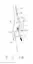 Fig. 07 - Method of using a minimal incision removable bone screw