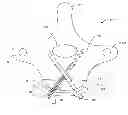 Fig. 01 - Vertebral screw arrangement with locking pin