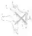 Fig. 05 - Vertebral screw arrangement with locking pin