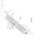Fig. 15 - Vertebral screw arrangement with locking pin
