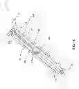Fig. 17 - Vertebral screw arrangement with locking pin