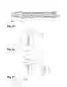Fig. 07 - Dynamic bone anchor and method of manufacturing a dynamic bone anchor