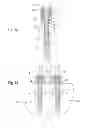 Fig. 06 - Dynamic bone anchor and method of manufacturing the same