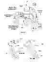 Fig. 02 - Methods and Devices for Portal Fixation to the Spine