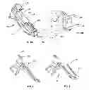 Fig. 04 - Methods and Devices for Portal Fixation to the Spine