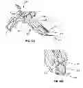 Fig. 06 - Methods and Devices for Portal Fixation to the Spine