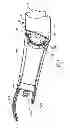 Fig. 04 - ADJUSTABLE INTERBODY INTRODUCER DEVICE AND METHOD