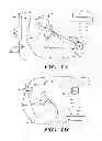 Fig. 02 - Data manipulation following delivery of a cardiac stimulus in an implantable cardiac stimulus device