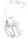 Fig. 01 - Method and system for detecting and treating junctional rhythms