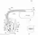 Fig. 01 - Method and apparatus for right ventricular resynchronization