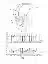 Fig. 02 - Active implantable medical device type such as a pacemaker with capture test by analysis of a vectogram