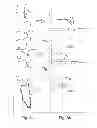 Fig. 05 - Active implantable medical device type such as a pacemaker with capture test by analysis of a vectogram