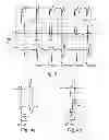 Fig. 03 - Active implantable medical device type such as a pacemaker with detection of anodal stimulation by analysis of a vectogram