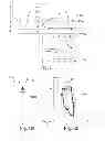 Fig. 04 - Active implantable medical device type such as a pacemaker with detection of anodal stimulation by analysis of a vectogram