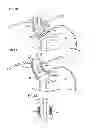 Fig. 07 - Controlled vagal blockage therapy