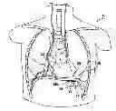 Fig. 01 - Hemodynamic performance enhancement through asymptomatic diaphragm stimulation