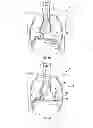 Fig. 04 - Hemodynamic performance enhancement through asymptomatic diaphragm stimulation