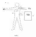 Fig. 12 - Implantable cardiac devices and methods