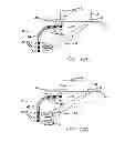 Fig. 09 - Implant, system and method using implanted passive conductors for routing electrical current