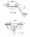 Fig. 10 - Implant, system and method using implanted passive conductors for routing electrical current