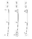 Fig. 13 - Implant, system and method using implanted passive conductors for routing electrical current
