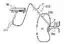 Fig. 01 - Methods for bilateral renal neuromodulation via catheter apparatuses having expandable baskets