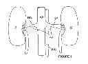 Fig. 02 - Methods for bilateral renal neuromodulation via catheter apparatuses having expandable baskets