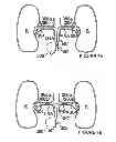 Fig. 09 - Methods for bilateral renal neuromodulation via catheter apparatuses having expandable baskets