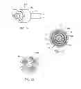 Fig. 12 - Implantable lead having a shielded bandstop filter comprising a self-resonant inductor for an active medical device