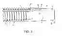 Fig. 04 - Flexible stent and delivery system