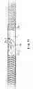 Fig. 09 - Flexible stent and delivery system