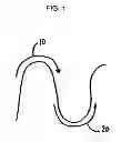 Fig. 02 - Medical balloon devices and methods