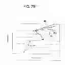 Fig. 15 - Medical balloon devices and methods