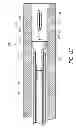 Fig. 15 - Luminal stenting