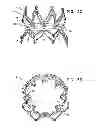 Fig. 05 - Stent fixation with reduced plastic deformation